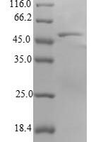 Human Ras-related protein Rab-18 (RAB18) Recombinant Protein - BioCrest Sci