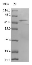 Human Ras-related protein Rab-18 (RAB18) Recombinant Protein, Homo sapiens (Human), E.coli, N-terminal GST-tagged, 49.7 kDa, purity >≥ 90% as determined by SDS-PAGE.