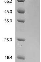 Human Interferon beta (IFNB1) Recombinant Protein, N-HSA/C-10His - BioCrest Sci