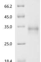 Human Netrin receptor UNC5C (UNC5C)(A150V),partial Recombinant Protein - BioCrest Sci