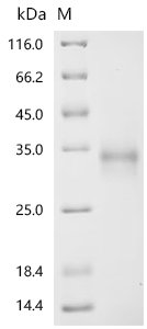 Human Netrin receptor UNC5C (UNC5C)(A150V),partial Recombinant Protein, Homo sapiens (Human), Yeast, C-terminal 6xHis-tagged, 25.8 kDa, purity >≥ 95% as determined by SDS-PAGE.