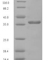 Saccharomyces cerevisiae Diphosphoinositol polyphosphate phosphohydrolase DDP1 (DDP1) Recombinant Protein - BioCrest Sci