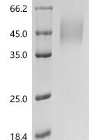 Human CD226 antigen (CD226), partial, Biotinylated Recombinant Protein - BioCrest Sci