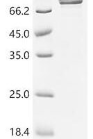 Human Bifunctional UDP-N-acetylglucosamine 2-epimerase/N-acetylmannosamine kinase (GNE) Recombinant Protein - BioCrest Sci