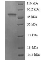 Human Na (+)/H (+) exchange regulatory cofactor NHE-RF3 (PDZK1) Recombinant Protein - BioCrest Sci