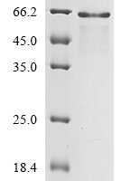 Enterobacteria phage M13 Attachment protein G3P (III) Recombinant Protein, N-10His - BioCrest Sci