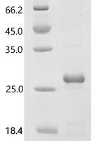 Human A-kinase anchor protein 4 (AKAP4), partial Recombinant Protein - BioCrest Sci