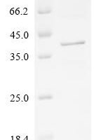 Human Deoxyribonuclease gamma (DNASE1L3) Recombinant Protein, C-His - BioCrest Sci