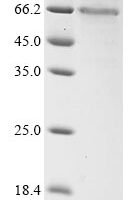 Arabidopsis thaliana Glucan endo-1,3-beta-glucosidase 10 (At5g42100) Recombinant Protein - BioCrest Sci
