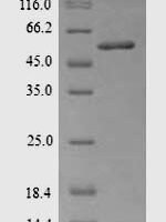 Rat Acetyl-CoA carboxylase 1 (Acaca), partial Recombinant Protein - BioCrest Sci