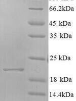 Hepatitis C virus genotype 1b Genome polyprotein, partial Recombinant Protein, N-His, aa 192–358 - BioCrest Sci