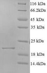 Hepatitis C virus genotype 1b Genome polyprotein, partial Recombinant Protein, N-His, aa 192–358, Hepatitis C virus genotype 1b (strain HC-J4) (HCV), Yeast, N-terminal 6xHis-tagged, 20.2 kDa, purity >≥ 90% as determined by SDS-PAGE.