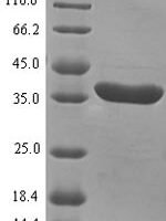 Magnaporthe oryzae Scytalone dehydratase (SDH1) Recombinant Protein - BioCrest Sci