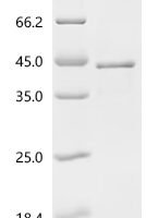 Rat Ly6/PLAUR domain-containing protein 3 (Lypd3) Recombinant Protein, C-His - BioCrest Sci