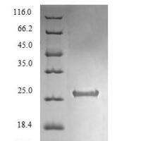 Mycobacterium tuberculosis Toxin RelG (relG) Recombinant Protein - BioCrest Sci