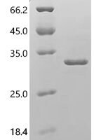 Mouse Neutrophil elastase (Elane) Recombinant Protein, C-His - BioCrest Sci