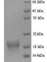 Mouse Bis (5'-adenosyl)-triphosphatase (Fhit) Recombinant Protein - BioCrest Sci