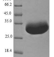 Escherichia coli Ditrans,polycis-undecaprenyl-diphosphate synthase ( (2E,6E)-farnesyl-diphosphate specific) (ispU) Recombinant Protein - BioCrest Sci