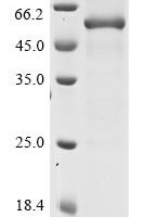 Porphyromonas gingivalis Gingipain R2 (rgpB) Recombinant Protein - BioCrest Sci