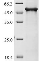 Human Atrial natriuretic peptide receptor 1 (NPR1), partial Recombinant Protein, C-12xHis - BioCrest Sci