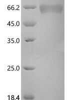 Human Erythropoietin (EPO) Recombinant Protein, C-hFc1 - BioCrest Sci