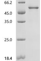 Mouse Platelet-derived growth factor D (Pdgfd) Recombinant Protein - BioCrest Sci