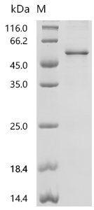 Mouse Platelet-derived growth factor D (Pdgfd) Recombinant Protein, Mammalian cell, C-terminal 10xHis-tagged, 46.4 kDa, purity >≥ 85% as determined by SDS-PAGE.