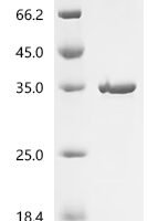 Drosophila melanogaster Tyrosine-protein kinase hopscotch (hop), partial Recombinant Protein, C-His - BioCrest Sci