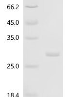 Human Probable global transcription activator SNF2L2 (SMARCA2), partial Recombinant Protein, N-His, aa 1350–1520 - BioCrest Sci