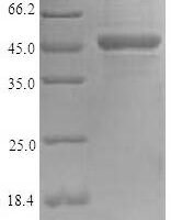 Glycine max Seed biotin-containing protein SBP65 (SBP65) Recombinant Protein - BioCrest Sci