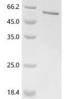Human tRNA (guanine-N(7)-)-methyltransferase non-catalytic subunit WDR4 (WDR4) Recombinant Protein - BioCrest Sci