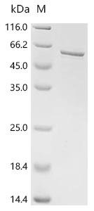 Human tRNA (guanine-N(7)-)-methyltransferase non-catalytic subunit WDR4 (WDR4) Recombinant Protein, Homo sapiens (Human), E.coli, C-terminal 6xHis-tagged, 52.3 kDa, purity >≥ 85% as determined by SDS-PAGE.