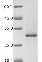 Pig Rhodopsin (RHO), partial Recombinant Protein, N-GST/C-His - BioCrest Sci