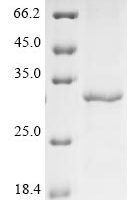 Human Cyclin-dependent kinase 5 (CDK5) Recombinant Protein, Tag-Free - BioCrest Sci