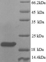 Human Plexin-A1 (PLXNA1), partial Recombinant Protein, N-His, aa 986–1152 - BioCrest Sci