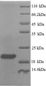 Human Plexin-A1 (PLXNA1), partial Recombinant Protein, N-His, aa 986–1152, Homo sapiens (Human), Yeast, N-terminal 6xHis-tagged, 20.3 kDa, purity >≥ 90% as determined by SDS-PAGE.
