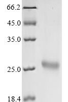 Avian infectious bronchitis virus Spike glycoprotein (S), partial Recombinant Protein, C-His, aa 317–537 - BioCrest Sci
