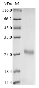 Avian infectious bronchitis virus Spike glycoprotein (S), partial Recombinant Protein, C-His, aa 317–537, Avian infectious bronchitis virus (strain M41) (IBV), E.coli, C-terminal 6xHis-tagged, 26.8 kDa, purity >≥ 90% as determined by SDS-PAGE.