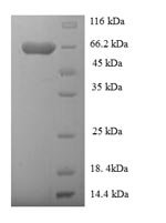 Human Rab GDP dissociation inhibitor beta (GDI2) Recombinant Protein, N-His-SUMO - BioCrest Sci