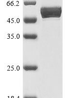 Human 40S ribosomal protein S6 (RPS6), partial Recombinant Protein - BioCrest Sci