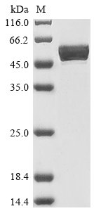 Human 40S ribosomal protein S6 (RPS6), partial Recombinant Protein, Homo sapiens (Human), E.coli, N-terminal 6xHis-GST-tagged, 53.9 kDa, purity >≥ 90% as determined by SDS-PAGE.