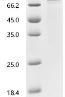 Human Uncharacterized protein C8orf34 (C8orf34) Recombinant Protein - BioCrest Sci