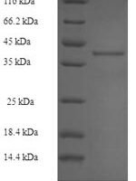 Human Ras-related protein Rab-27B (RAB27B) Recombinant Protein - BioCrest Sci