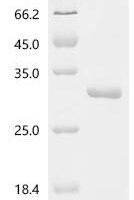 Neisseria gonorrhoeae Ribonuclease HII (rnhB) Recombinant Protein, C-His - BioCrest Sci