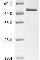 Macaca fascicularis Paraneoplastic antigen Ma2 homolog (PNMA2) Recombinant Protein, N-10His/C-Myc - BioCrest Sci