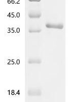 Mouse Transforming growth factor beta-3 proprotein (Tgfb3), partial Recombinant Protein, N-hFc1 - BioCrest Sci