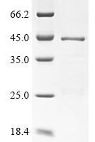 Hepatitis B virus genotype D subtype ayw Protein P (P), partial Recombinant Protein - BioCrest Sci