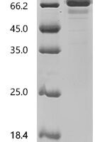 Human Vitronectin (VTN) Recombinant Protein, C-10His - BioCrest Sci