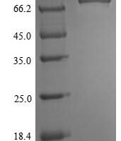 Mouse Receptor-interacting serine/threonine-protein kinase 1 (Ripk1) Recombinant Protein, N-His-SUMOstar - BioCrest Sci