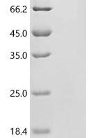 Chlamydia trachomatis serovar D Histone H1-like protein Hc1 (hctA) Recombinant Protein, C-His, aa 2–125, Yeast - BioCrest Sci